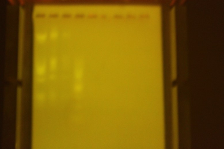 Blurry, but that is my fault.  Definitely enough light for a photo.